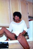 ATK hairy  in mature and hairy