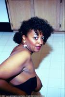 ATK hairy  in mature and hairy