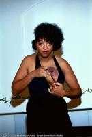 ATK hairy  in mature and hairy