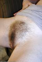 ATK hairy  in mature and hairy