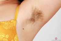 ATK hairy  in young and hairy