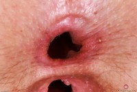 ATK hairy Dria Submits Set