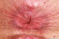 ATK hairy Dria Submits Set