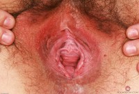 ATK hairy  in young and hairy