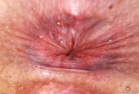 ATK hairy Dria Submits Set