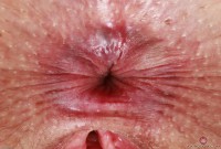 ATK hairy Dria Submits Set