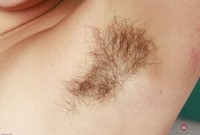 ATK hairy  in young and hairy