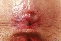 ATK hairy Dria Submits Set