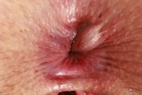 ATK hairy Dria Submits Set