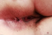 ATK hairy  in young and hairy