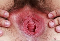 ATK hairy  in young and hairy