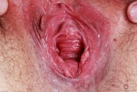 ATK hairy Dria Submits Set