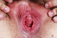 ATK hairy Dria Submits Set