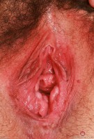 ATK hairy Dria Submits Set