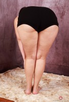 ATK hairy  in mature and hairy