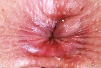 ATK hairy Dria Submits Set