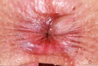 ATK hairy Dria Submits Set