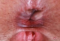 ATK hairy Dria Submits Set