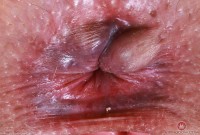 ATK hairy Dria Submits Set