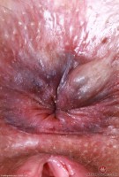 ATK hairy Dria Submits Set