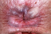 ATK hairy Dria Submits Set