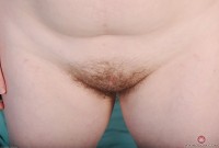 ATK hairy  in young and hairy