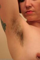 ATK hairy  in mature and hairy