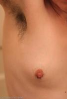 ATK hairy  in mature and hairy