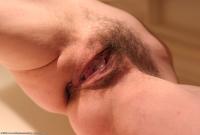 ATK hairy  in mature and hairy