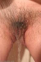 ATK hairy  in mature and hairy