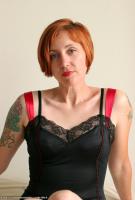 ATK hairy  in mature and hairy