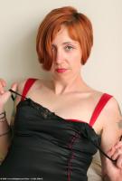 ATK hairy  in mature and hairy