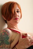 ATK hairy  in mature and hairy