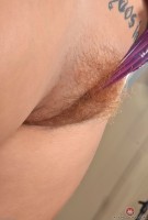 ATK hairy  in young and hairy