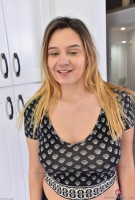 ATK hairy  in young and hairy