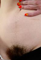 ATK hairy  in young and hairy