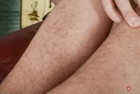 ATK hairy  in mature and hairy