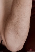 ATK hairy  in mature and hairy