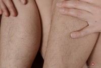 ATK hairy  in mature and hairy