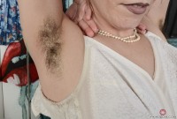 ATK hairy  in mature and hairy