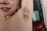 ATK hairy  in mature and hairy