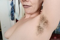 ATK hairy  in mature and hairy
