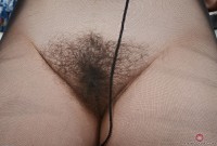 ATK hairy  in mature and hairy