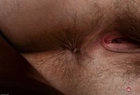ATK hairy  in mature and hairy