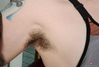 ATK hairy  in mature and hairy