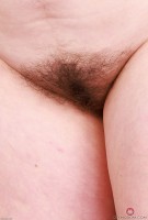 ATK hairy  in mature and hairy