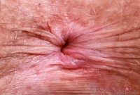 ATK hairy Elizabeth Set