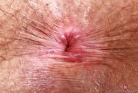 ATK hairy Elizabeth Set