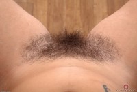 ATK hairy  in mature and hairy