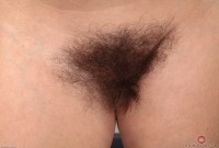 ATK hairy  in mature and hairy